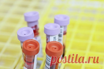 Россияне пожаловались на Genotek из-за задержек выдачи результатов генетических тестов