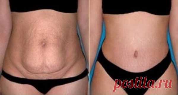 WEIGHT LOSS Archives - Page 3 of 3 - Healthy Life Always