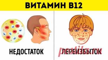 6 важных фактов, которые следует знать о приеме витаминов — Домашний уют