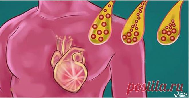 Продукты, которые вы должны ежедневно потреблять для очистки артерий! 



Атеросклероз является основной причиной сердечно-сосудистых заболеваний, и это состояние прогрессирующего засорения артерий.
Артерии на самом деле являются кровеносными сосудами, роль которых закл…
