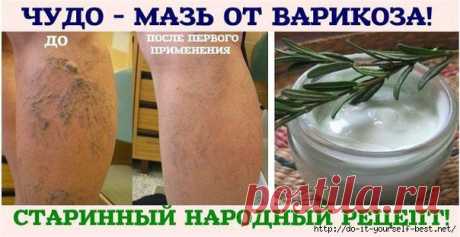 ЧУДО - МАЗЬ ОТ ВАРИКОЗА!.