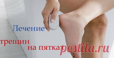КАК ЛЕЧИТЬ ТРЕЩИНЫ НА ПЯТКАХ — Копилочка полезных советов