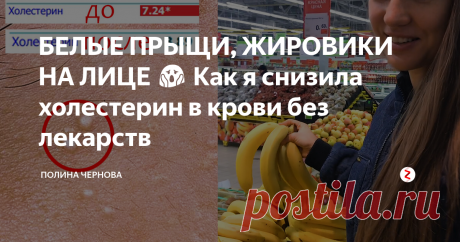 БЕЛЫЕ ПРЫЩИ, ЖИРОВИКИ НА ЛИЦЕ 😱 Как я снизила холестерин в крови без лекарств В этой статье я расскажу свою историю, как я избавилась от белый прыщей, жировиков на лице и снизила свой уровень холестерина в крови без лекарств.
Примерно 2 месяца назад я заметила на своем лице белые подкожные прыщики, жировики были у меня как-то давно, но я их успешно удалила с косметолога. Но причина их появления была не устранена. Я решила сдать холестерин, чтобы убедиться, что проблема в эт