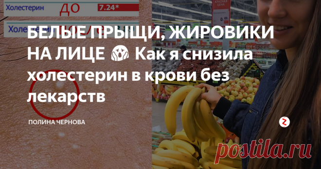 БЕЛЫЕ ПРЫЩИ, ЖИРОВИКИ НА ЛИЦЕ 😱 Как я снизила холестерин в крови без лекарств В этой статье я расскажу свою историю, как я избавилась от белый прыщей, жировиков на лице и снизила свой уровень холестерина в крови без лекарств.
Примерно 2 месяца назад я заметила на своем лице белые подкожные прыщики, жировики были у меня как-то давно, но я их успешно удалила с косметолога. Но причина их появления была не устранена. Я решила сдать холестерин, чтобы убедиться, что проблема в эт