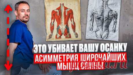 Видео Асимметрия широчайших мышц спины и ПРОБЛЕМЫ С ОСАНКОЙ — что делать? Массаж | OK.RU