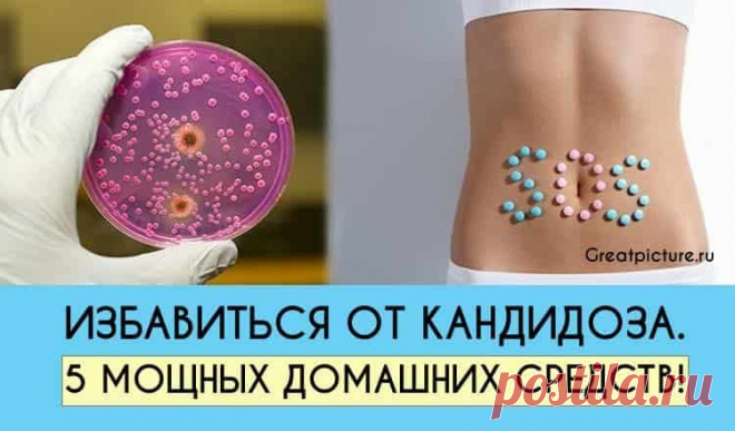 ИЗБАВИТЬСЯ ОТ КАНДИДОЗА. 5 МОЩНЫХ ДОМАШНИХ СРЕДСТВ