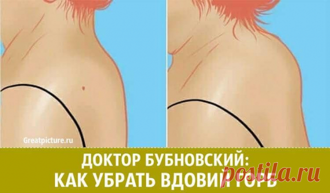 Доктор Бубновский: Как убрать ВДОВИЙ ГОРБ. Лучший способ!