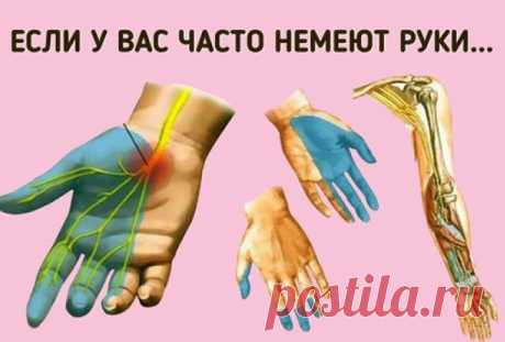 Причины онемения рук. Срочно к врачу