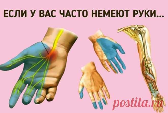 Причины онемения рук. Срочно к врачу