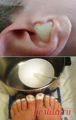 Нетрадиционное лечение: перекись водорода по Неумывакину