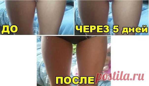 Медово-горчичное обертывание