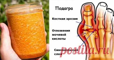 Попрощайтесь с подагрой навсегда с помощью этого мощного природного лечения!