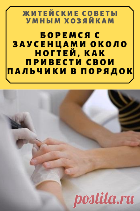 Боремся с заусенцами около ногтей, или как привести свои пальчики в порядок | Житейские Советы