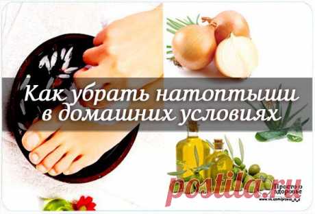 Как убрать натоптыши в домашних условиях | Советы Народной Мудрости