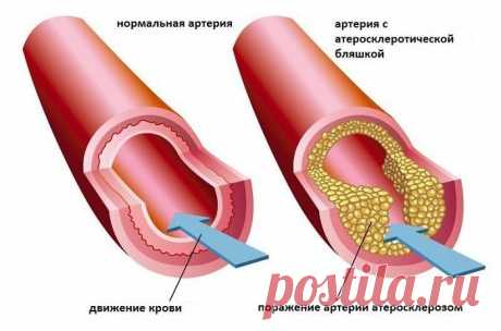 8 лучших продуктов для чистки сосудов! / Будьте здоровы