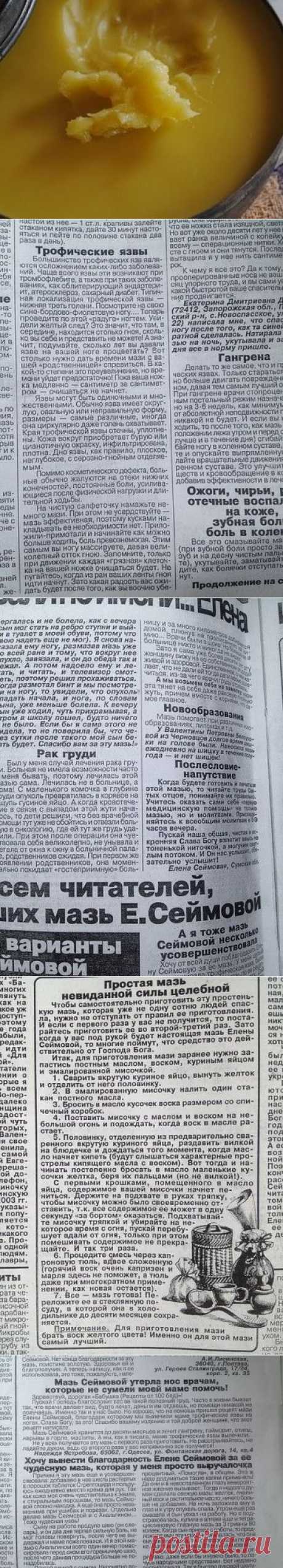 ЧУДО МАЗЬ ОТ ВАЛЕНТИНЫ СЕЙМОВОЙ + отзывы людей после применении этой мази.

Эта мазь лечит много болезней: фибромы, мастопатия, мастит, гангрена, язвы (в том числе и трофические), ожоги, чирьи, нарывы, больные суставы, самые застарелые гаймориты, гнойные отиты, нарывы в горле, экзема, кисты яичников — все это вылечит чудо- мазь! Мазь Валентины Сеймовой