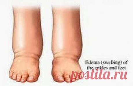 Чтобы отеки не мешали | Друг пенсионера