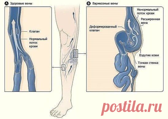 (52) Одноклассники ТРОМБ