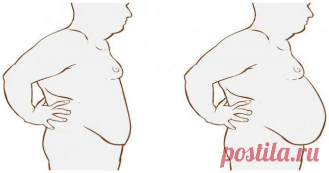 Как избавиться от раздутого живота за несколько минут с помощью этого невероятного рецепта  - Журнал для женщин Это чудо, о котором все мечтали! Есть ли у вас большой круглый живот? Те люди, у которых есть, ищут способ избавиться от него. Сасси-вода — это чудо, о котором все мечтали! Имя его изобретателя Синтия Сасс. Основным ингредиентом в ее рецепте является обычная вода, которая превращается в замечательное зелье, которое очень быстро сжигает жир живота! […]