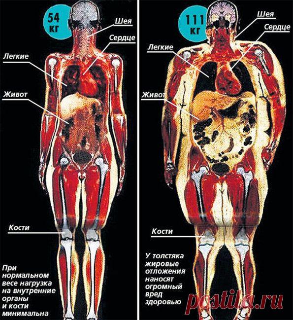 Коротко и ясно. Сравнение анатомии людей с разным весом.