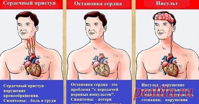 Это может спасти вам жизнь: разница между инфарктом, инсультом и остановкой сердца - Образованная Сова Чем больше вы знаете о том, что происходит с вашим телом, тем больше у вас шансов спасти себя и знать, когда отдать себя в руки медицинской команды. Эта статья определяет три основных угрожающих жизни события, показывает их симптомы и предлагает, что делать в каждой ситуации. Терминология Сердечный приступ:  Сердечный приступ – резкий и иногда смертельный …