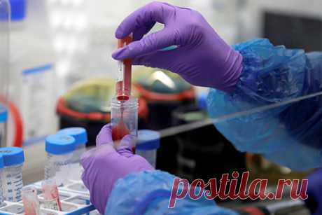 Женщина приняла неизлечимую болезнь за стресс после смерти матери. 39-летняя Лора Маклафин из английского города Вулверхэмптон, графство Уэст-Мидлендс, потеряла мать и приняла симптомы смертельно опасной болезни за реакцию организма на стресс. Британка пожаловалась на боль в левом боку и обратилась к врачам. В ходе обследований у нее диагностировали хронический миелоидный лейкоз.