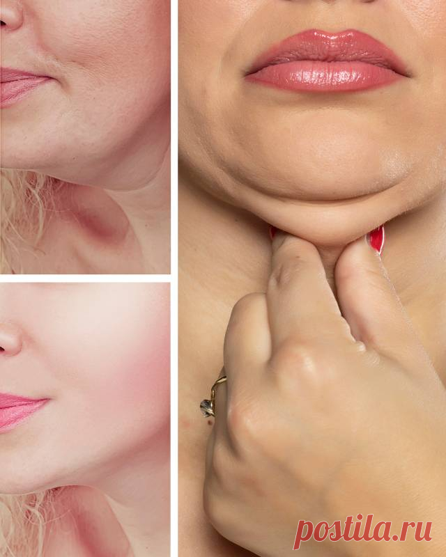 Как избавиться от второго подбородка? — Гармония в тебе