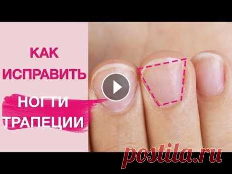 Маникюр на трапециевидные короткие ногти. Как изменить? 1313%Как визуально исправить трапециевидные, короткие ногти растущие вверх ? Можно ли оставить короткую длину? Или обязательно делать наращивание ногт...