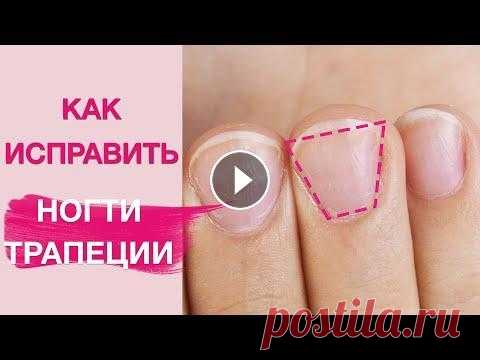 Маникюр на трапециевидные короткие ногти. Как изменить? 1313%Как визуально исправить трапециевидные, короткие ногти растущие вверх ? Можно ли оставить короткую длину? Или обязательно делать наращивание ногт...