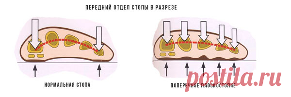 Комплект 