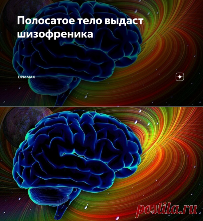 Полосатое тело выдаст шизофреника | dpmmax | Яндекс Дзен