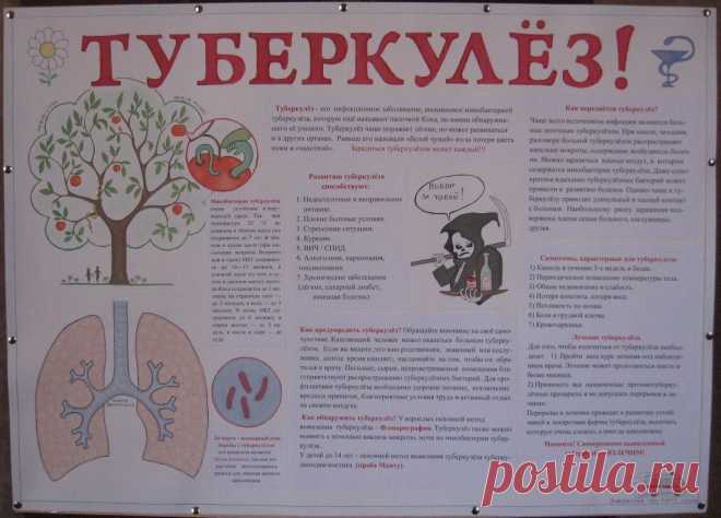 Туберкулёз,санбюллетень