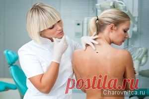 (+1) Удаление папиллом и бородавок народными средствами