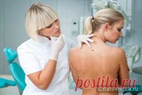 (+1) Удаление папиллом и бородавок народными средствами