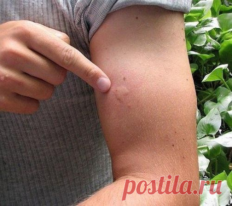 действительно чудодейственным средством от комаров