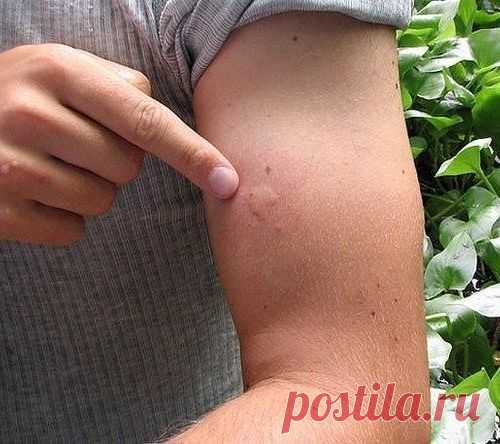 действительно чудодейственным средством от комаров