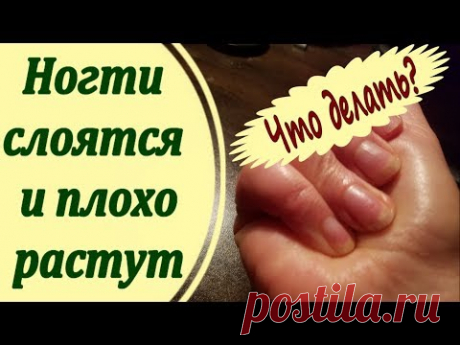 Болят кисти рук: причины, что делать, как лечить	Почему болят кисти рук и пальцы: основные причины. Что делать, если болят кисти при сгибании, немеют, опухают и отекают.Что делать, если болят кисти рук: лечение и профилактика. Устранение последствий травм. Лечение заболеваний кистей рук