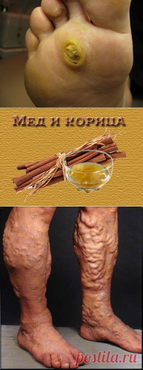 (99+) Одноклассники