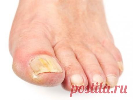 Десять необычных домашних средств, которые действительно лечат