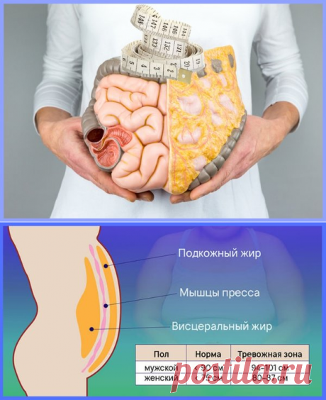 Как избавиться от висцерального жира | Школа Снижения Веса | Яндекс Дзен