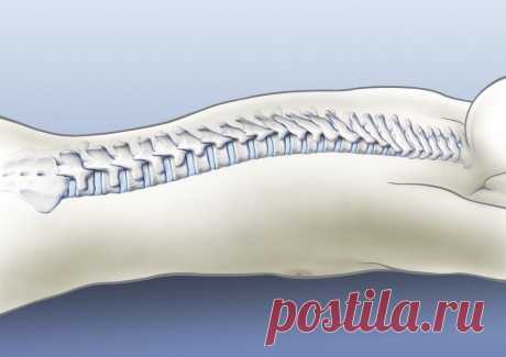 Операции по фиксации позвоночника (Spinalfusion)

фиксация позвоночника Рассел Гиббс изменил лицо хирургии по фиксации позвоночника в Нью-Йорке в период с 1914 по 1919 года, используя эту процедуру для лечения 59 пациентов, большинство из которых имели полиомиелит, а также перенесли предоперационную коррекцию методом вытяженияот головы до бедра. Поднадкостнично он...