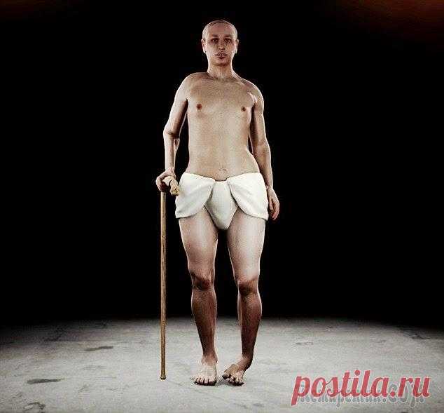 10 исторических личностей, страдавших ужасными болезнями