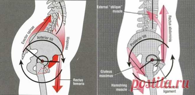 4 упражнения для коррекции переднего наклона таза | KinesioPro