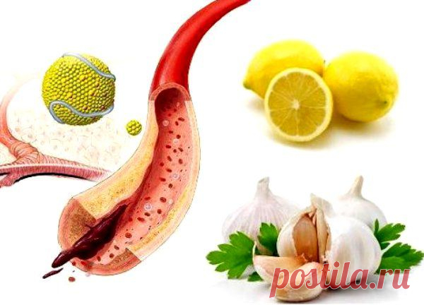 (+1) тема - Как очистить сосуды по народным рецептам | ВСЕГДА В ФОРМЕ!