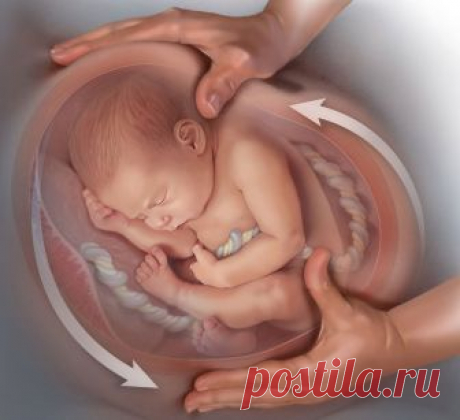 Что такое родовая травма и как она влияет на жизнь человека Если человек никогда не сталкивался с этой темой, то слова "родовая травма" вызывают в воображении какие-нибудь ужасные картины, происходящие в родах. Возникает страх и вполне естественное желание не трогать эту тему и порадоваться за себя, что вот я жив и здоров, и никакой травмы у меня нет. Это и так, и не так.