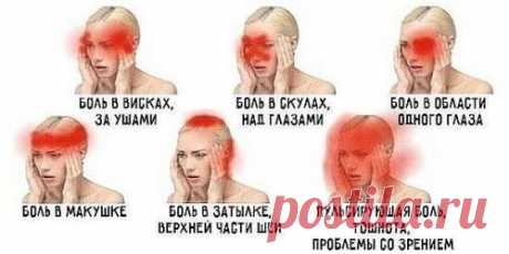 О чем говорит боль в разных частях головы?
