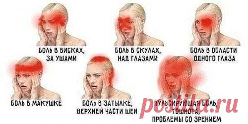 О чем говорит боль в разных частях головы?