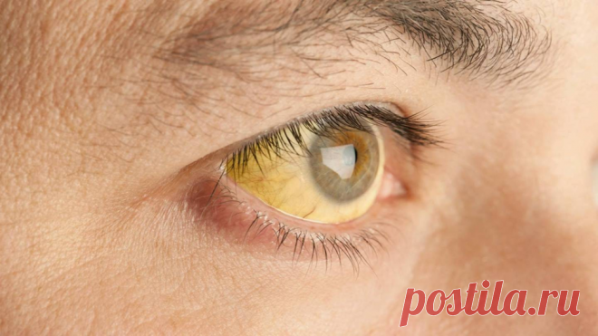 Цирроз печени — как заметить его на ранней стадии | Evolutis Clinic | Дзен