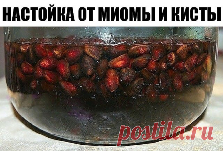 От миомы и кисты настойка из кедровых орешков

Настойка из кедровых сибирских орешков лечит миому матки и кисту яичников.

Приготовление настойки:

Один стакан кедровых орешков вместе с кожурой и ядрами залить 0,5 литра водки (или разведённого спирта), настоять 2 недели в тёмном месте, периодически встряхивая.

Приём настойки:

По одной столовой ложке настойки три раза в день, за 30 минут до еды. Можно развести в 40 мл. воды.

Лечение длительное, 3-6 месяцев. В идеале надо...