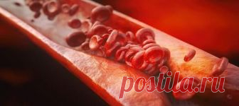 Холестериновые бляшки в сосудах. Как избавиться? Холестериновые бляшки в сосудах. Как избавиться? Эффективное народное средство. Рецепт простой, и много времени на его приготовление Вам не понадобится.